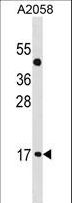 ATOH7 / MATH5 Antibody - ATOH7 Antibody western blot of A2058 cell line lysates (35 ug/lane). The ATOH7 antibody detected the ATOH7 protein (arrow).