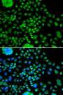 ATOH7 / MATH5 Antibody - Immunofluorescence analysis of MCF7 cells.