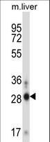 ATOH8 Antibody - ATOH8 Antibody western blot of mouse liver tissue lysates (35 ug/lane). The ATOH8 antibody detected the ATOH8 protein (arrow).