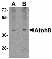 ATOH8 Antibody - Western blot of ATOH8 in A-20 cell lysate with ATOH8 antibody at (A) 1 and (B) 2 ug/ml. Below: Immunohistochemistry of ATOH8 in mouse brain tissue with ATOH8 antibody at 5 ug/ml.