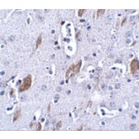 ATOH8 Antibody - Immunohistochemistry of ATOH8 in mouse brain tissue with ATOH8 antibody at 5 µg/mL.