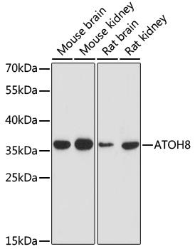 ATOH8 Antibody - Western blot analysis of extracts of various cell lines using ATOH8 Polyclonal Antibody at dilution of 1:1000.