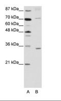 ATOH8 Antibody - A: Marker, B: Jurkat Cell Lysate.  This image was taken for the unconjugated form of this product. Other forms have not been tested.