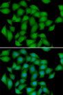 ATOX1 Antibody - Immunofluorescence analysis of HeLa cells.