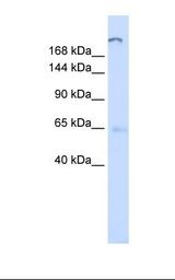 ATP10D Antibody - Fetal liver lysate. Antibody concentration: 1.0 ug/ml. Gel concentration: 6-18%.  This image was taken for the unconjugated form of this product. Other forms have not been tested.