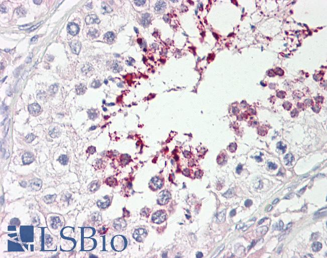 ATP10D Antibody - Anti-ATP10D antibody IHC of human testis. Immunohistochemistry of formalin-fixed, paraffin-embedded tissue after heat-induced antigen retrieval. Antibody dilution 2.5-5 ug/ml. This image was taken for the unconjugated form of this product. Other forms have not been tested.
