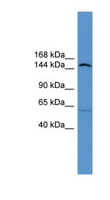 ATP10D Antibody - ATP10D antibody Western blot of Rat Lung lysate. This image was taken for the unconjugated form of this product. Other forms have not been tested.