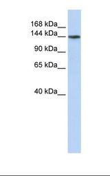 ATP11B Antibody - Fetal liver lysate. Antibody concentration: 1.0 ug/ml. Gel concentration: 6-18%.  This image was taken for the unconjugated form of this product. Other forms have not been tested.