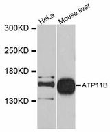 ATP11B Antibody - Western blot analysis of extracts of various cell lines, using ATP11B antibody at 1:1000 dilution. The secondary antibody used was an HRP Goat Anti-Rabbit IgG (H+L) at 1:10000 dilution. Lysates were loaded 25ug per lane and 3% nonfat dry milk in TBST was used for blocking. An ECL Kit was used for detection and the exposure time was 90s.