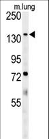 ATP11C Antibody - ATP11C Antibody western blot of mouse lung tissue lysates (35 ug/lane). The ATP11C antibody detected ATP11C protein (arrow).