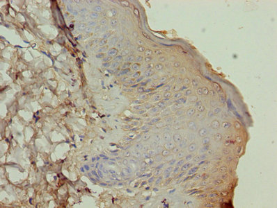 ATP12A Antibody - Immunohistochemistry of paraffin-embedded human skin tissue using ATP12A Antibody at dilution of 1:100