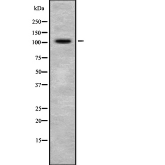 ATP12A Antibody - Western blot analysis of ATP12A expression in mouse liver tissue lysate. The lane on the left is treated with the antigen-specific peptide.