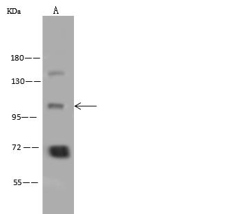 ATP12A Antibody - Anti-ATP12A rabbit polyclonal antibody at 1:500 dilution. Lane A: K562 Whole Cell Lysate. Lysates/proteins at 30 ug per lane. Secondary: Goat Anti-Rabbit IgG (H+L)/HRP at 1/10000 dilution. Developed using the ECL technique. Performed under reducing conditions. Predicted band size: 116 kDa. Observed band size: 116 kDa.
