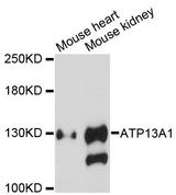 ATP13A1 Antibody - Western blot analysis of extracts of various cell lines, using ATP13A1 antibody at 1:3000 dilution. The secondary antibody used was an HRP Goat Anti-Rabbit IgG (H+L) at 1:10000 dilution. Lysates were loaded 25ug per lane and 3% nonfat dry milk in TBST was used for blocking. An ECL Kit was used for detection and the exposure time was 90s.