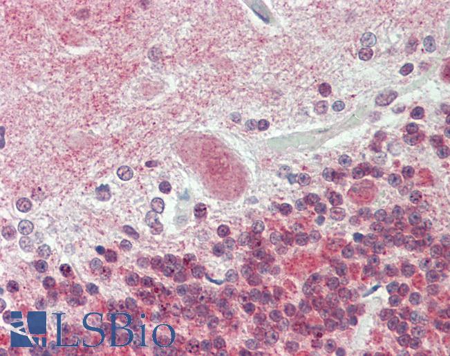 ATP13A2 Antibody - Anti-ATP13A2 antibody IHC staining of human brain, cerebellum. Immunohistochemistry of formalin-fixed, paraffin-embedded tissue after heat-induced antigen retrieval. Antibody dilution 1:100.  This image was taken for the unconjugated form of this product. Other forms have not been tested.
