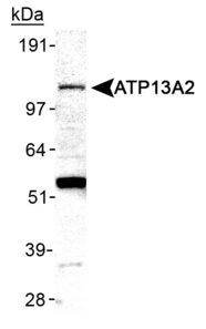 ATP13A2 Antibody - Detection of ATP13A2 in mouse brain membrane lysate.  This image was taken for the unconjugated form of this product. Other forms have not been tested.