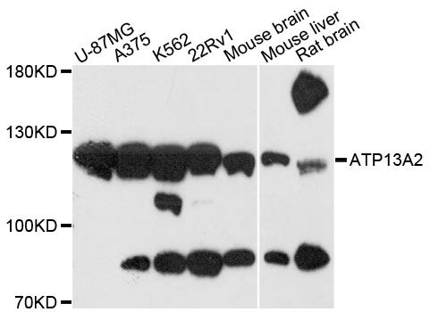 ATP13A2 Antibody - Western blot analysis of extracts of various cell lines, using ATP13A2 antibody at 1:3000 dilution. The secondary antibody used was an HRP Goat Anti-Rabbit IgG (H+L) at 1:10000 dilution. Lysates were loaded 25ug per lane and 3% nonfat dry milk in TBST was used for blocking. An ECL Kit was used for detection and the exposure time was 30s.