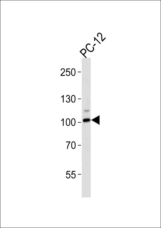 ATP1A1 Antibody - Western blot of lysate from PC-12 cell line with Rat Atp1a1 Antibody (Ser23). Antibody was diluted at 1:1000 at each lane. A goat anti-rabbit IgG H&L (HRP) at 1:5000 dilution was used as the secondary antibody. Lysate at 35 ug per lane.