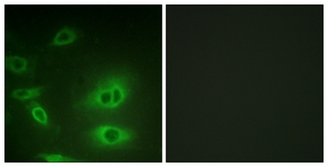 ATP1A1 Antibody - Immunofluorescence of HeLa cells, using ATP1 alpha1/Na+K+ ATPase1 (Ab-23) Antibody. The picture on the right is treated with the synthesized peptide.