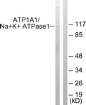 ATP1A1 Antibody - Western blot of extracts from HeLa cells, using ATP1 alpha1/Na+K+ ATPase1 (Ab-23) Antibody. The lane on the right is treated with the synthesized peptide.