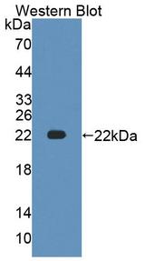 ATP1A1 Antibody - Western blot of ATP1A1 antibody.