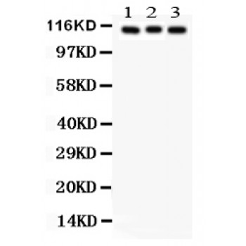 ATP1A1 Antibody - ATP1A1 antibody Western blot. All lanes: Anti ATP1A1 at 0.5 ug/ml. Lane 1: Rat Brain Tissue Lysate at 50 ug. Lane 2: A549 Whole Cell Lysate at 40 ug. Lane 3: HELA Whole Cell Lysate at 40 ug. Predicted band size: 113 kD. Observed band size: 113 kD.