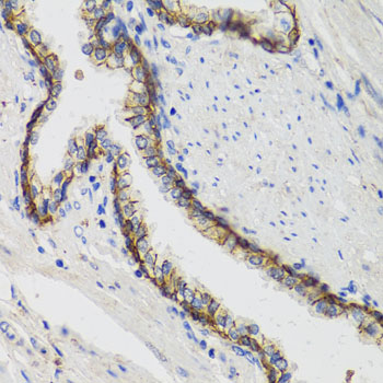ATP1A1 Antibody - Immunohistochemistry of paraffin-embedded human prostate.