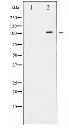 ATP1A1 Antibody - Western blot of ATP1alpha1/Na+K+ ATPase1 expression in HeLa whole cell lysates,The lane on the left is treated with the antigen-specific peptide.