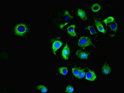 ATP1A1 Antibody - Immunofluorescent analysis of MCF-7 cells using ATP1A1 Antibody at dilution of 1:100 and Alexa Fluor 488-congugated AffiniPure Goat Anti-Rabbit IgG(H+L)