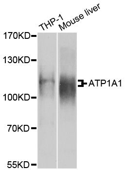 ATP1A1 Antibody - Western blot analysis of extracts of various cell lines, using ATP1A1 antibody at 1:1000 dilution. The secondary antibody used was an HRP Goat Anti-Rabbit IgG (H+L) at 1:10000 dilution. Lysates were loaded 25ug per lane and 3% nonfat dry milk in TBST was used for blocking. An ECL Kit was used for detection and the exposure time was 15s.