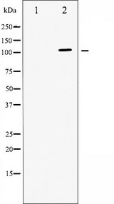 ATP1A1 Antibody - Western blot analysis of ATPase expression in PMA treated 293 whole cells lysates. The lane on the left is treated with the antigen-specific peptide.