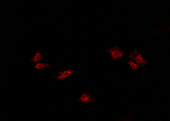 ATP1A1 Antibody - Staining 293 cells by IF/ICC. The samples were fixed with PFA and permeabilized in 0.1% Triton X-100, then blocked in 10% serum for 45 min at 25°C. The primary antibody was diluted at 1:200 and incubated with the sample for 1 hour at 37°C. An Alexa Fluor 594 conjugated goat anti-rabbit IgG (H+L) antibody, diluted at 1/600, was used as secondary antibody.