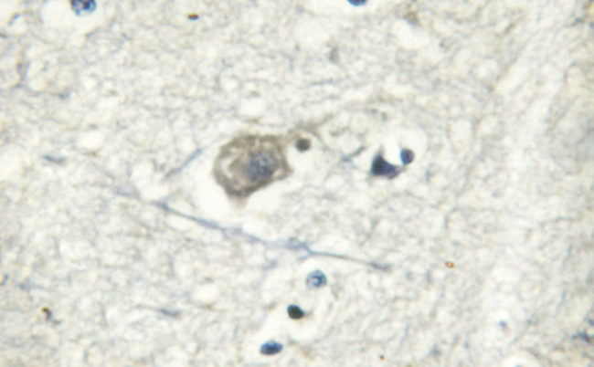 ATP1A1 Antibody - 1:50 dilution staining ATPase in human brain by IHC using paraffin-embedded tissue