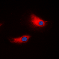 ATP1A1 Antibody - Immunofluorescent analysis of ATP1A1 staining in HeLa cells. Formalin-fixed cells were permeabilized with 0.1% Triton X-100 in TBS for 5-10 minutes and blocked with 3% BSA-PBS for 30 minutes at room temperature. Cells were probed with the primary antibody in 3% BSA-PBS and incubated overnight at 4 C in a humidified chamber. Cells were washed with PBST and incubated with a DyLight 594-conjugated secondary antibody (red) in PBS at room temperature in the dark. DAPI was used to stain the cell nuclei (blue).