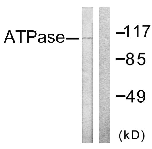 ATP1A1 Antibody - Western blot analysis of extracts from 293 cells, treated with PMA (125ng/ml, 30mins), using ATPase (Ab-16) antibody.