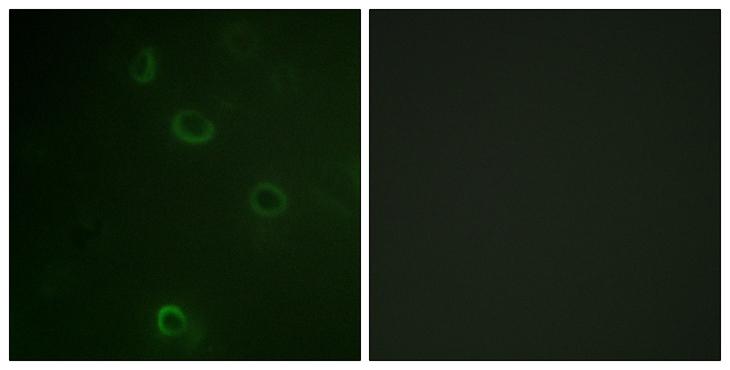 ATP1A1 Antibody - Peptide - + Immunofluorescence analysis of COS7 cells, using ATPase (Ab-16) antibody.