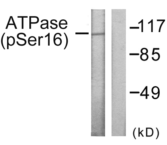 ATP1A1 Antibody - Western blot analysis of lysates from 293 cells treated with PMA 125ng/ml 30', using ATPase (Phospho-Ser16) Antibody. The lane on the right is blocked with the phospho peptide.