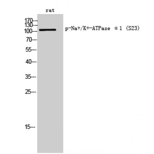 ATP1A1 Antibody - Western blot of Phospho-Na+/K+-ATPase alpha1 (pSer16) antibody