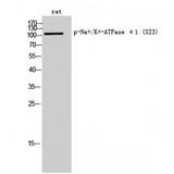 ATP1A1 Antibody - Western blot of Phospho-Na+/K+-ATPase alpha1 (pSer16) antibody