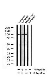 ATP1A1 Antibody - Western blot analysis of Phospho-ATPase (Ser16) expression in various lysates