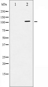 ATP1A1 Antibody - Western blot analysis of ATPase phosphorylation expression in PMA treated 293 whole cells lysates. The lane on the left is treated with the antigen-specific peptide.