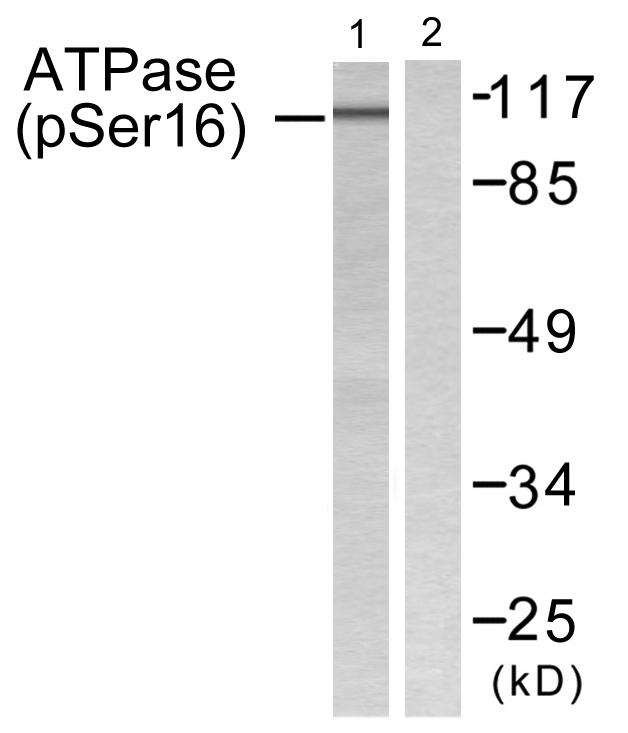 ATP1A1 Antibody - Western blot analysis of extracts from 293 cells, treated with PMA (125ng/ml, 30mins), using ATPase (Phospho-Ser16) antibody.