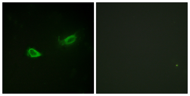 ATP1A1 Antibody - Immunofluorescence analysis of NIH/3T3 cells, using ATP1 alpha1/Na+K+ ATPase1 (Phospho-Ser23) Antibody. The picture on the right is blocked with the phospho peptide.