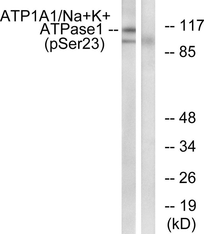 ATP1A1 Antibody - Western blot analysis of lysates from rat brain, using ATP1 alpha1/Na+K+ ATPase1 (Phospho-Ser23) Antibody. The lane on the right is blocked with the phospho peptide.