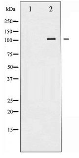 ATP1A1 Antibody - Western blot of ATP1 alpha1/Na+K+ ATPase1 phosphorylation expression in Rat brain tissue lysates,The lane on the left is treated with the antigen-specific peptide.