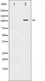 ATP1A1 Antibody - Western blot analysis of ATP1 alpha1/Na+K+ ATPase1 phosphorylation expression in rat brain tissue lysates. The lane on the left is treated with the antigen-specific peptide.