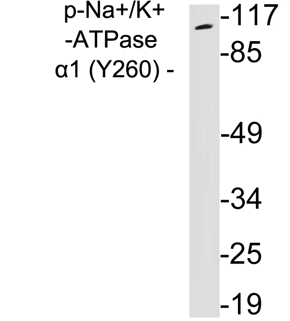 ATP1A1 Antibody - Western blot analysis of lysates from 293 cells treated with PMA, using phospho-Na+/K+-ATPase Î±1 (Phospho-Tyr260) antibody.