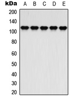 ATP1A2 Antibody - Western blot analysis of ATP1A2 expression in K562 (A); HepG2 (B); NIH3T3 (C); mouse brain (D); COS7 (E) whole cell lysates.