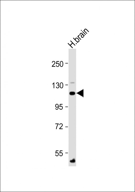 ATP1A4 Antibody - Anti-ATP1A4 Antibody (N-Term) at 1:2000 dilution + Human brain lysate Lysates/proteins at 20 µg per lane. Secondary Goat Anti-Rabbit IgG, (H+L), Peroxidase conjugated at 1/10000 dilution. Predicted band size: 114 kDa Blocking/Dilution buffer: 5% NFDM/TBST.