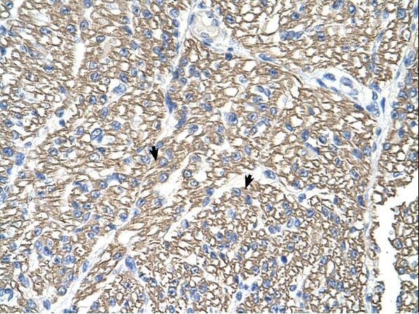 ATP1B1 Antibody - Paraffin embedded tissue: Human Heart. Cells with positive label: Myocardial cells (indicated with arrows). Antibody concentration: 4-8 ug/ml. Magnification: 400X.  This image was taken for the unconjugated form of this product. Other forms have not been tested.